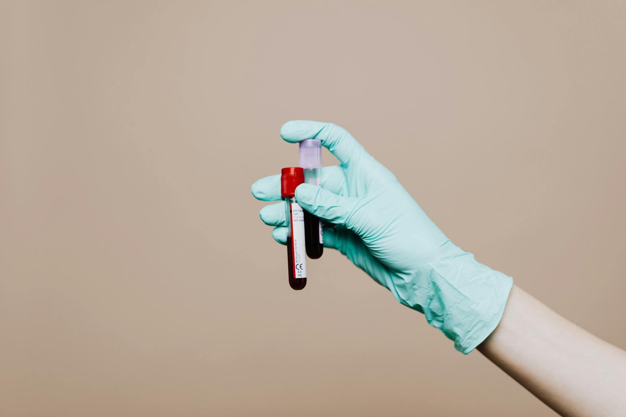 The Science Behind Xcellara™: Harnessing the Power of Cellular Regeneration